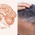 Die Wissenschaft erklärt den Zusammenhang zwischen Stress und grauem Haar