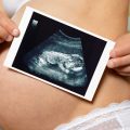 Warum Ultraschall-Untersuchung während der Schwangerschaft schädlich ist